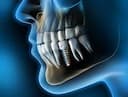 Oral and maxillofacial surgery 
